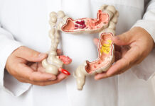 Alerta de saúde: câncer de intestino cresce entre jovens e preocupa especialistas