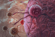 Nova estratégia reacende esperança no combate ao câncer