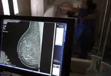 Guia orienta médicos sobre pedidos de mamografia digital pelos planos de saúde